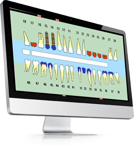 layer slider